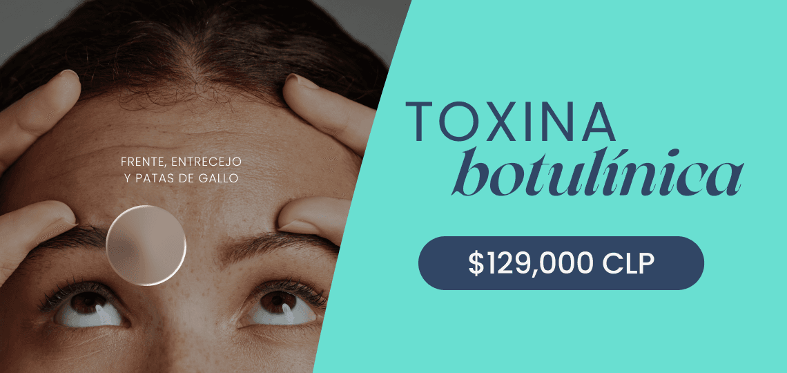 Botox facial — $129.000 CLP