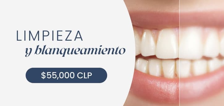 Limpieza y blanqueamiento — $55.000 CLP